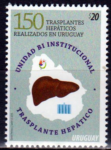 Transplantation Hepatitis