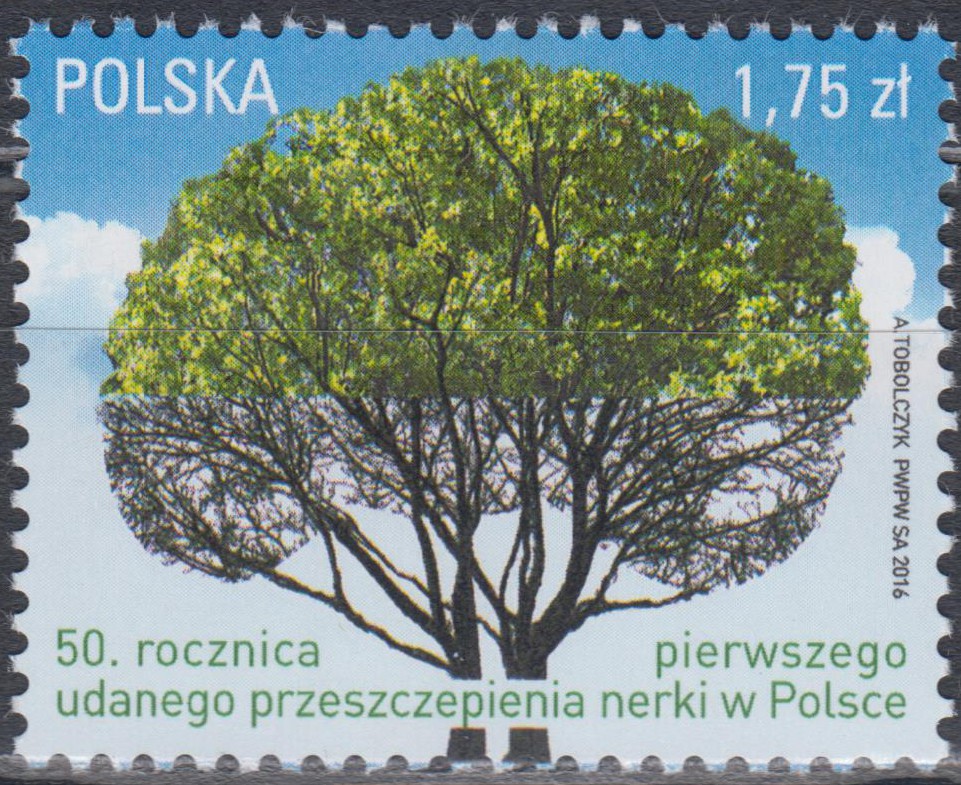 Nierentransplantation (16P06)