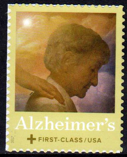 Alzheimer 2017, sk
